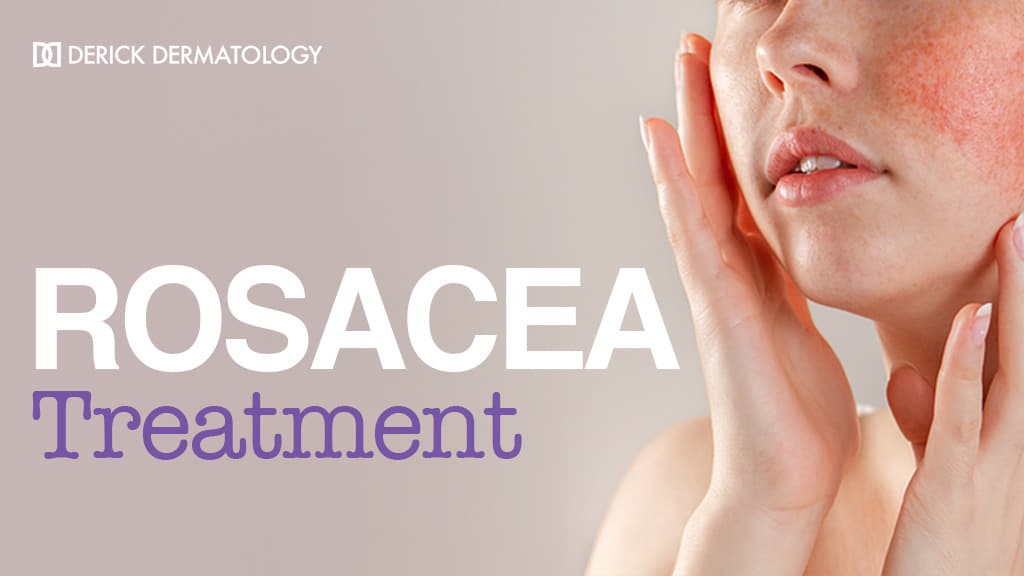 Rosacea Treatment - Dermatology